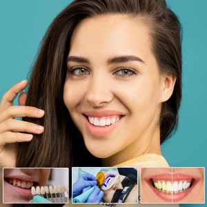 4 Cosmetic Dentistry to Try in Winter