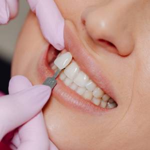 Dental Crowns: 6 Ways to Improve Your Smile 