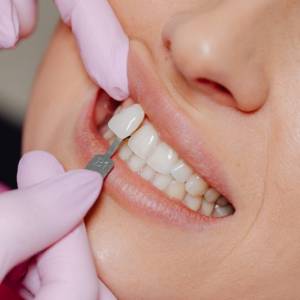 3 Cosmetic Dentistry Treatments for Summer